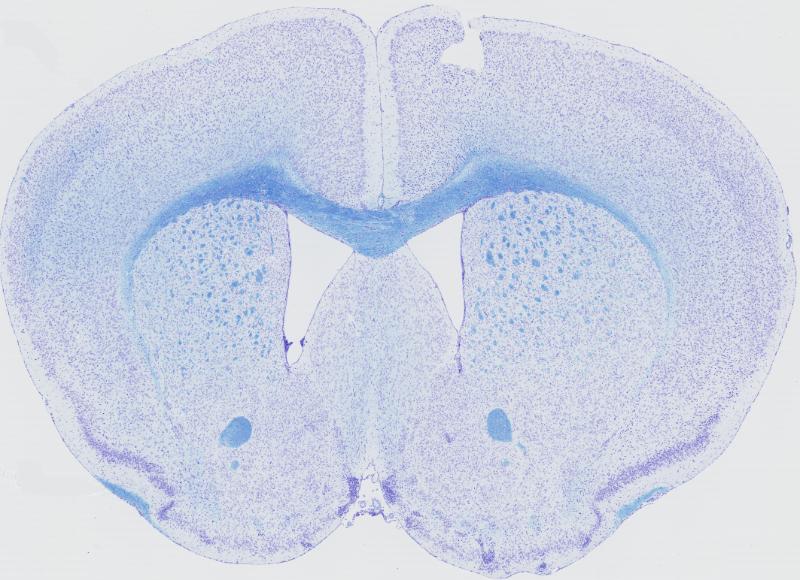 Large-scale neuroanatomical study uncovers 198 gene associations in mouse  brain morphogenesis